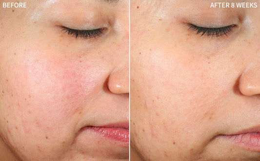 Zafrani Glow Cream