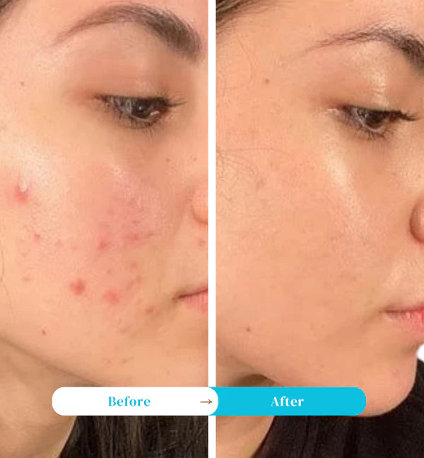 Teashell Niacinamide Serum